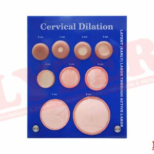 Cervical Dilation Model