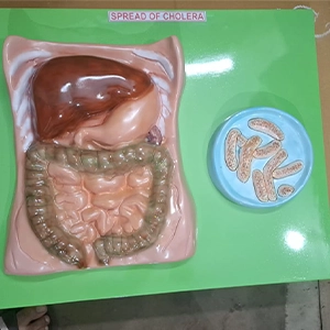 Cholera Disease Spread Demonstration Model