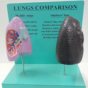 Lungs Comparison Model (Healthy vs Smokers’ Lung)