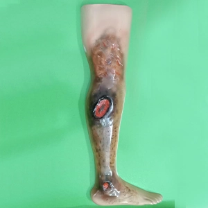 Electric Burn Injury Training Model